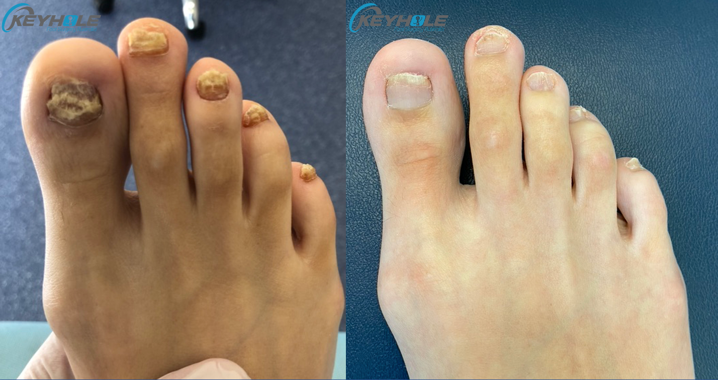 Recensione cliente MICOBLOCK