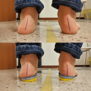 Foto prodotto EasyFoot