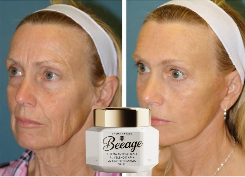 Risultati Maria T. - Prima e Dopo