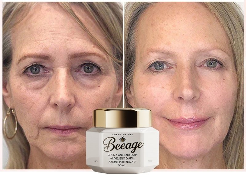 Risultati Francesca L. - Prima e Dopo