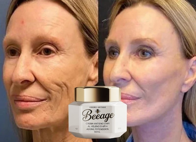 Risultati Laura B. - Prima e Dopo