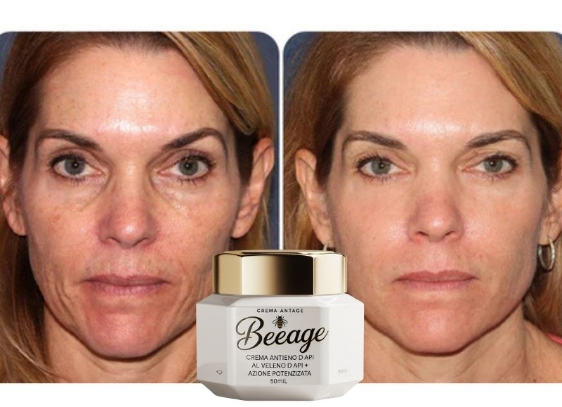 Risultati Alessandra P. - Prima e Dopo